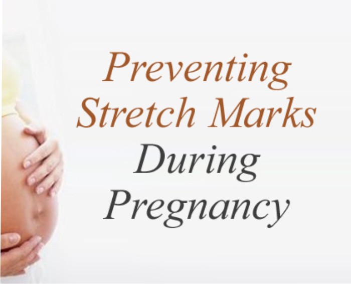 Preventing stretch marks in pregnancy