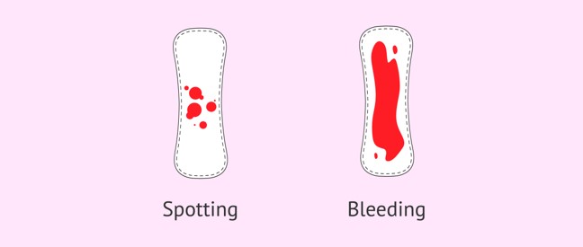 Bleeding During Pregnancy When To Worry Fabmoms